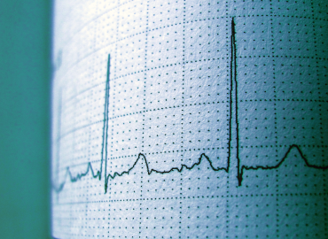Any airline which isn't screening all its pilots for cardiac issues is risking a disaster that will cost hundreds of innocent lives